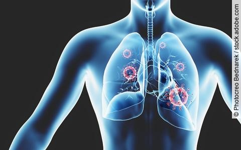 Lunge, medizinische Illustration