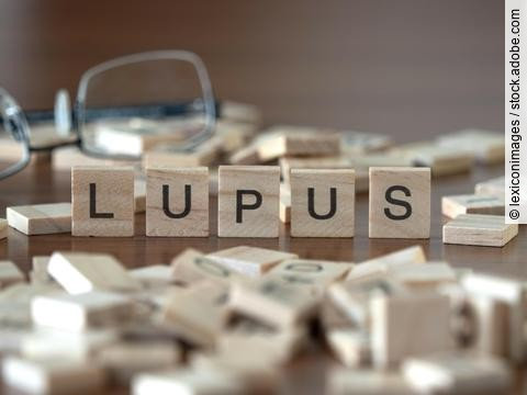 Holzbuchstaben bilden das Wort Lupus. 