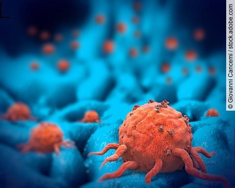 3-D-Illustration: Krebszellen